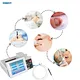vascular lesion therapy